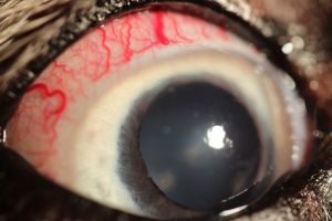 Glaukom, gestaute Gefäße der weißen Augenhaut