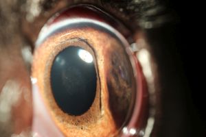 Ein Iristumor verdrängt das Gewebe, die Pupille ist verschoben
